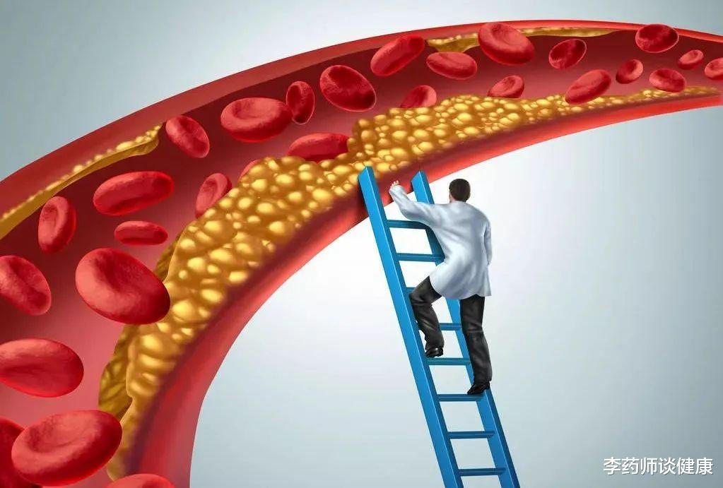 中国科学家首次发现!这种常见的B族维生素,或可防治动脉粥样硬化