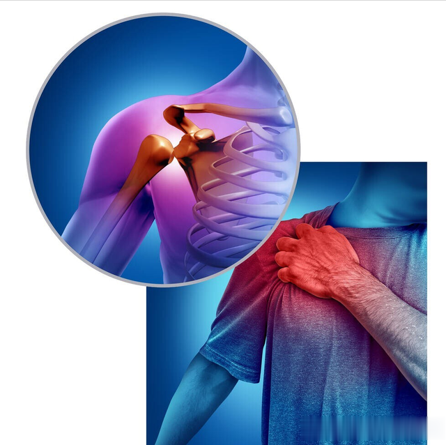 熬夜|肩膀疼痛是怎么回事?本文告知您6种病因,让您再也不盲目咨询