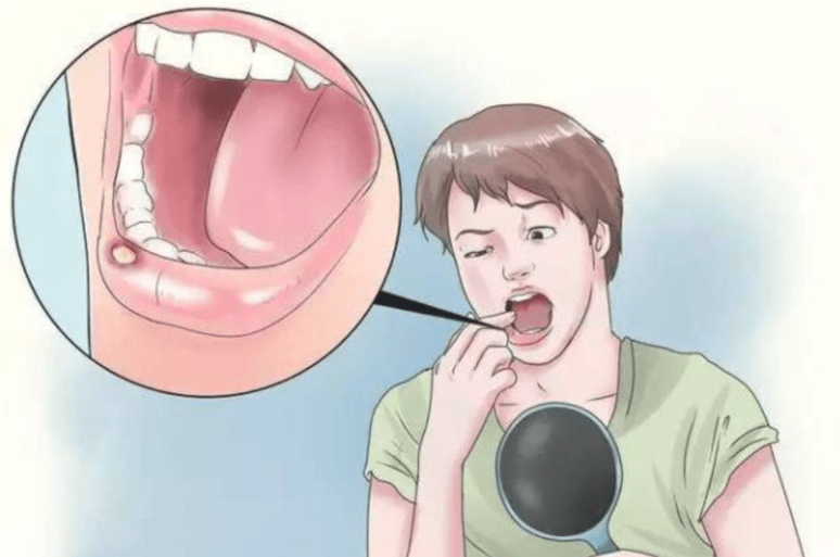 上热下寒，多是中焦不通！一个千古名方，轻松打通中焦，引火归元