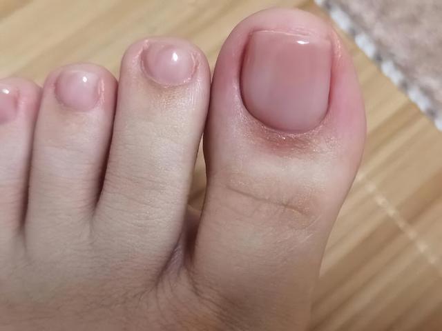 衰老|肝不好,“脚”先知?提醒:若脚上出现5种异常,建议早做筛查