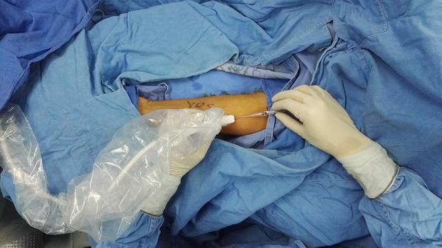 转氨酶|谷丙转氨酶高是怎么回事？高到多少可判定为肝癌？看看医生怎么说