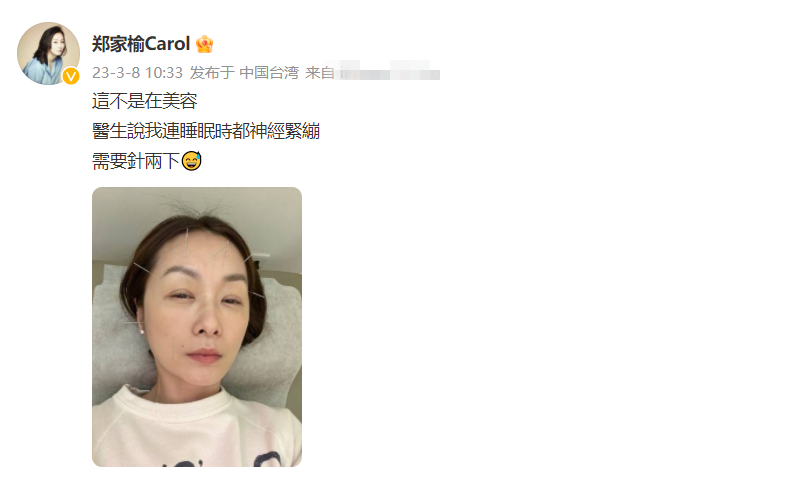 曾黎|郑家榆脸上扎满针,自曝精神很差!51岁仍未婚,羡慕别人结婚生娃!