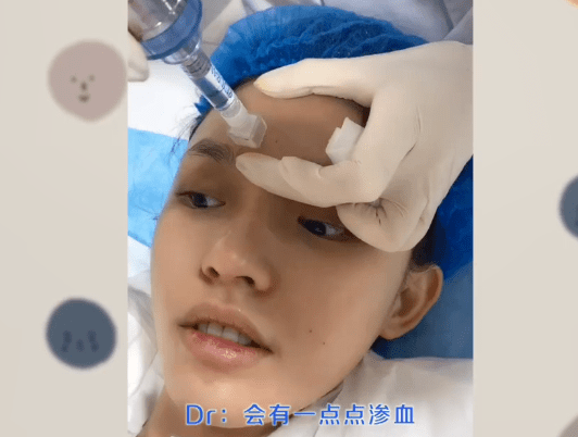 宁静扎900针,倪萍鼻孔外翻,明星里的打针族,掀开了娱圈遮羞布