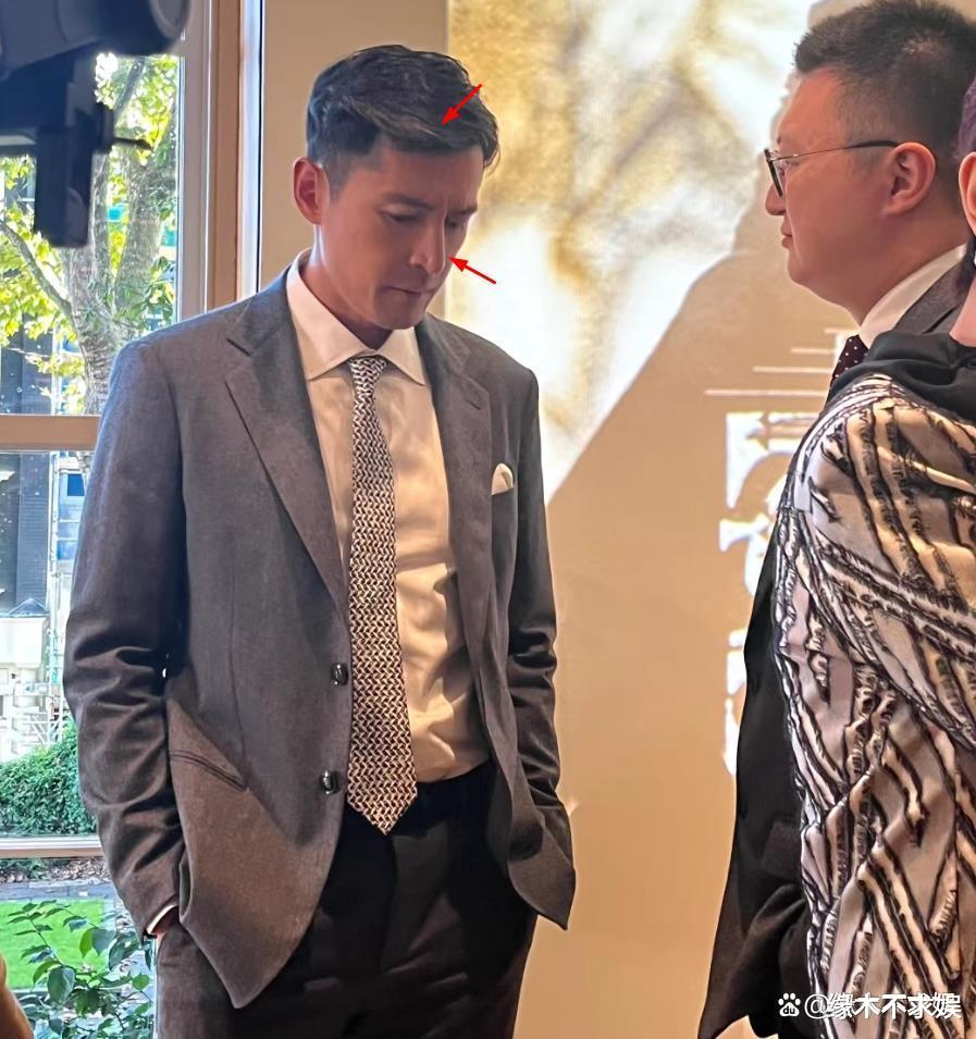 41岁胡歌伦敦开会！颜值回春变帅气，生图白发抢镜，疤痕加深！