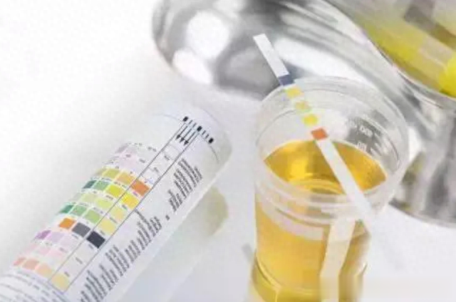 这四个降尿酸最快的方法，做好哪一条，都能让你少吃或不吃西药