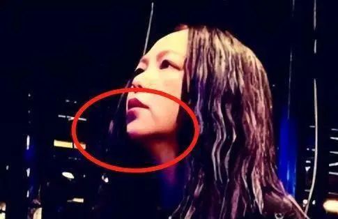 张惠妹|50岁张惠妹现状:为了瘦身,出奇招,瘦是瘦了,专家说太极端!