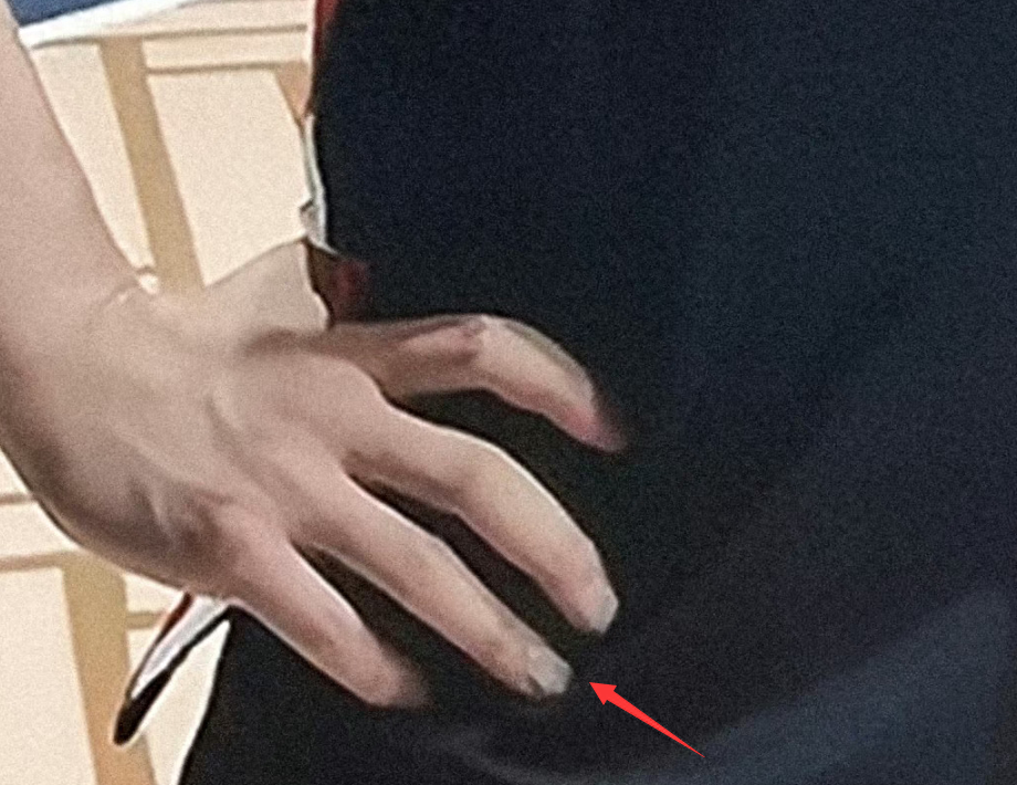 李易峰打篮球被偶遇,消瘦太多黑眼圈加重,手腕全是伤惹猜测