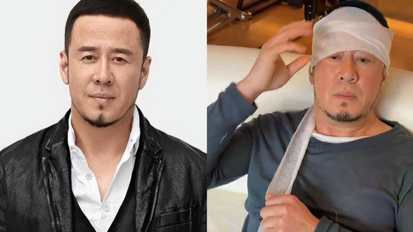 50岁杨坤湖南演出被人胖揍？鼻青脸肿？本人头裹纱布出镜回应