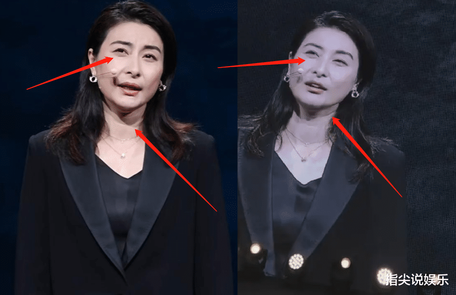 郭晶晶活动演讲,颈纹多层,眼袋明显老10岁,霍启刚与3美女合影