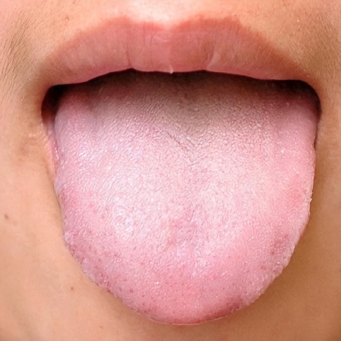 建议收藏——详细的舌象解析