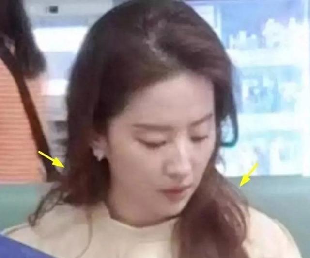 36岁刘亦菲医院拍戏被偶遇，泪眼婆娑楚楚可怜，“女儿”似翻版！