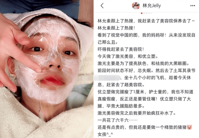 宁静扎900针,倪萍鼻孔外翻,明星里的打针族,掀开了娱圈遮羞布