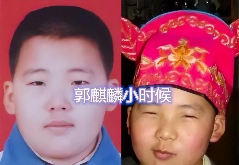 |郭麒麟,让世界刮目相看