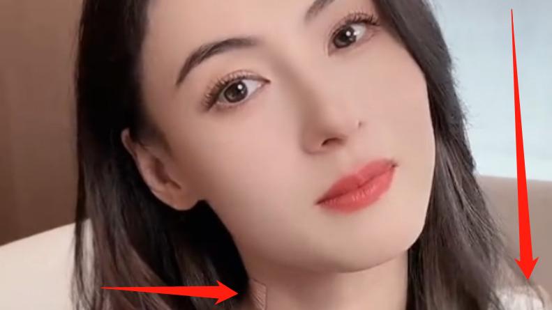 张柏芝休长假后首露面！脖贴膏药、肩膀绑绷带，始终不露肚引猜测