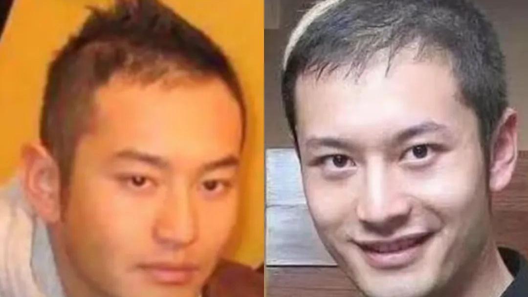 黄晓明为治秃头，花了多少冤枉钱