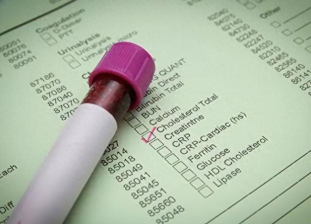 体检报告出现4种情况，最好到医院进一步检查下，可能是大病提示