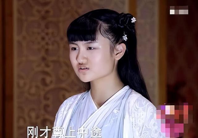 4位长残的童星,因肥胖被北影拒绝,头秃沦为路人,丑的千奇百怪