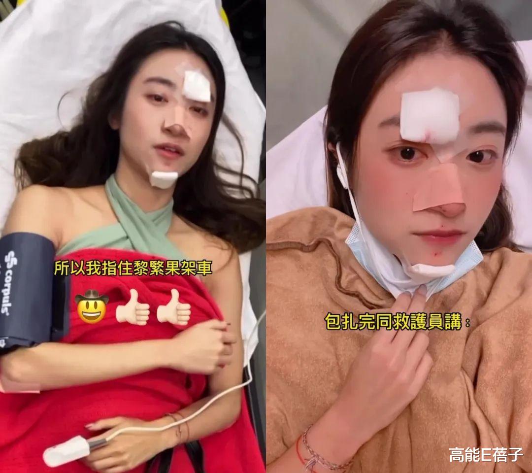 |27岁港星黄紫恩突然晕倒直扑地面，下巴骨裂惨致毁容