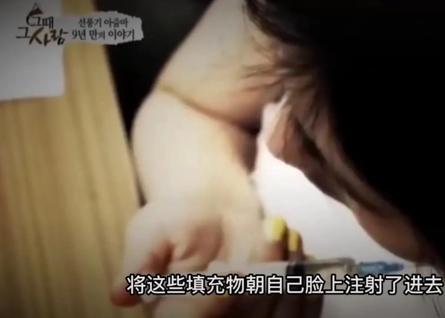 韩慧景|28岁女歌星整容成瘾!缺钱整容自己动手:脸上注射香油和水泥!