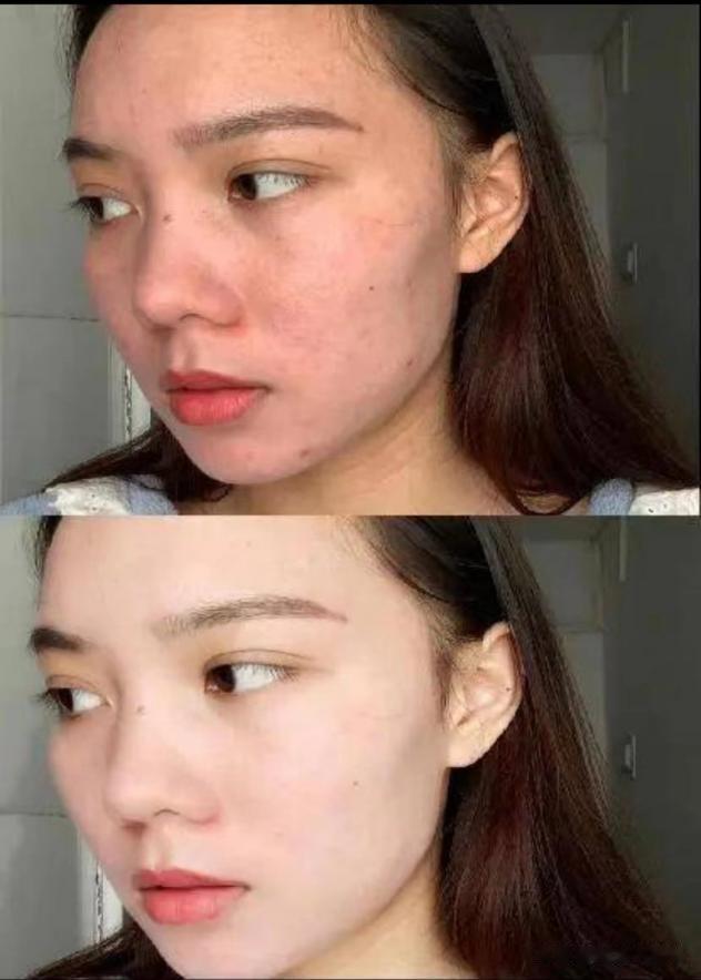 明星素颜 “长期化妆”和“长期素颜”的女生，皮肤差距能有多大？答案在这
