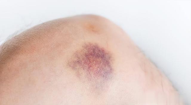 脾胃“阴毒”不除，越补越堵！3个中成药，横扫身体里的湿 痰 瘀