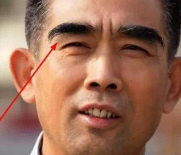 男性50岁以后眉毛变长，意味着什么？医生：建议了解