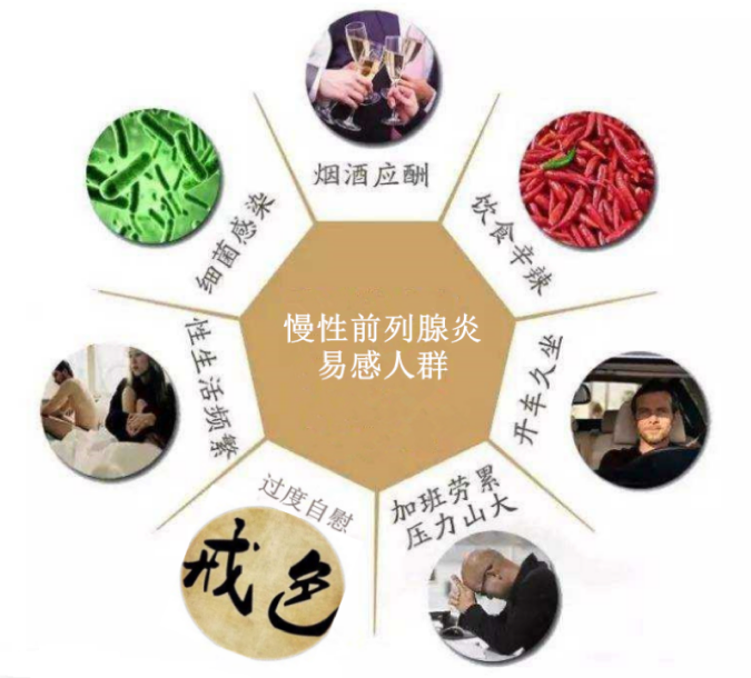 中医治疗前列腺炎，这一方有效