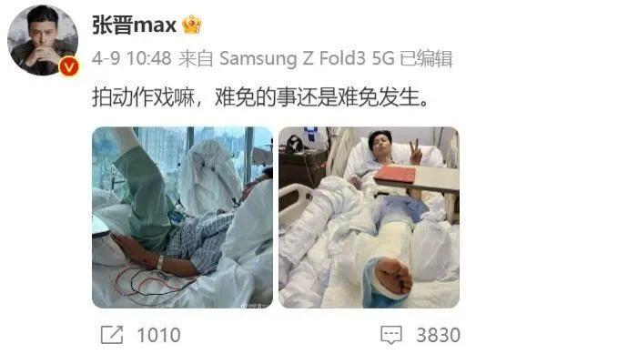 张晋|张晋拍戏重伤住院，蔡少芬别人互动引争议？