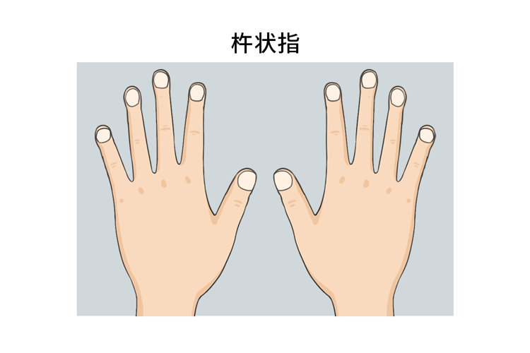 人到70岁多看手，长不长寿能显现？医生：手上出现4种异常要重视