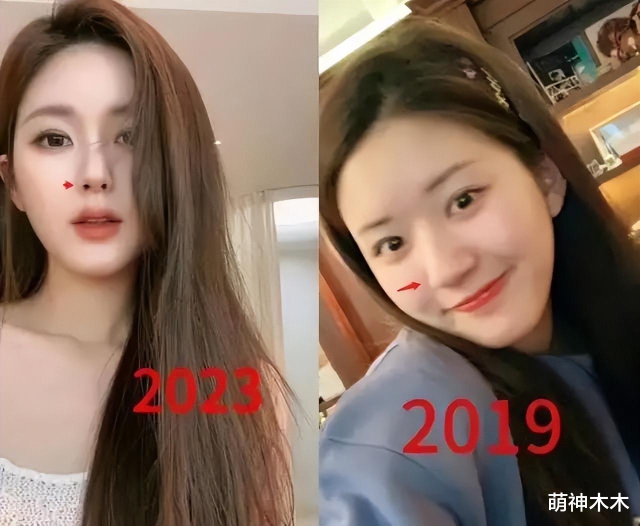 赵露思近照引发围观，嘴唇怪异妆容油腻，网友吐槽医美恢复期