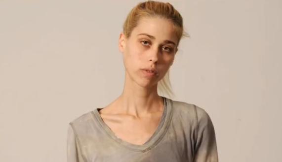 瓜子|35岁以色列模特身患厌食症，抗争十多年去世后体重仅46斤