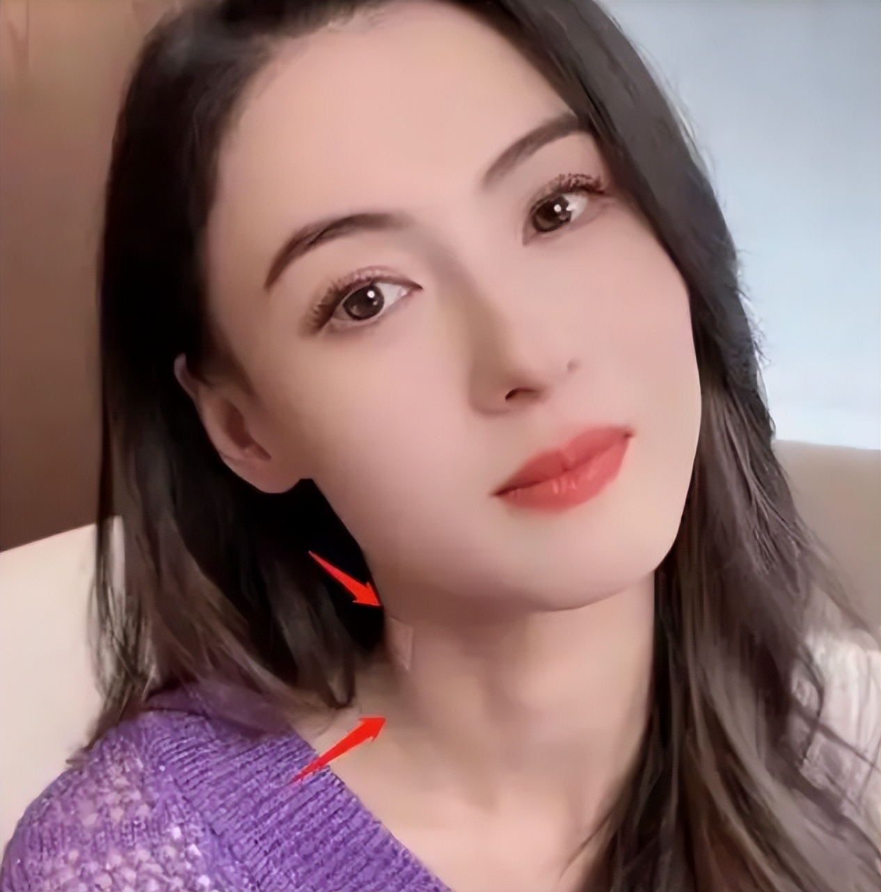 张柏芝出院后首亮相，脖颈现“草莓”印记，镜前摇头晃脑心情愉悦