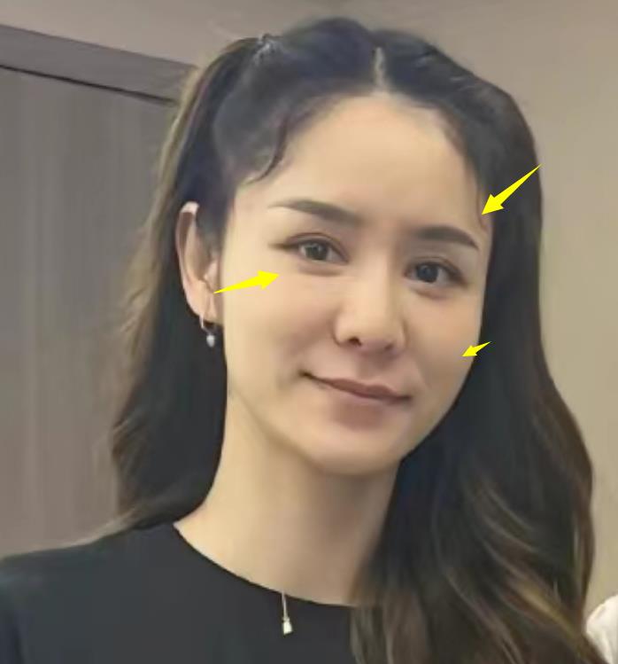 林峰妻子张馨月生照片曝光,毛孔粗大老10岁,和林峰发际线双双上移