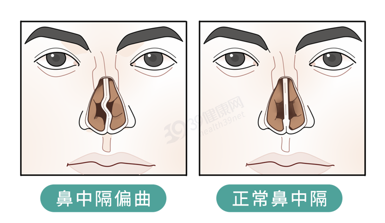 一觉醒来，他四肢瘫痪：2种最舒服的睡觉姿势，正毁掉你的脊椎