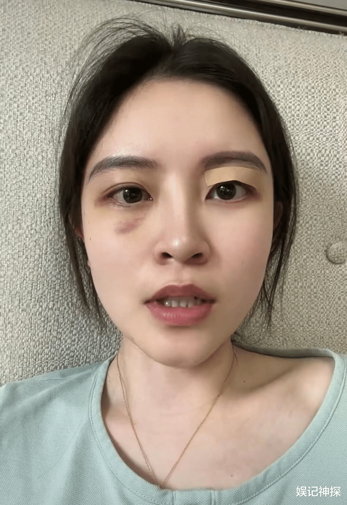 曝好声音学员酥睿力挺李玟!发声后却鼻青脸肿,网友喊话胡锡进主持公道