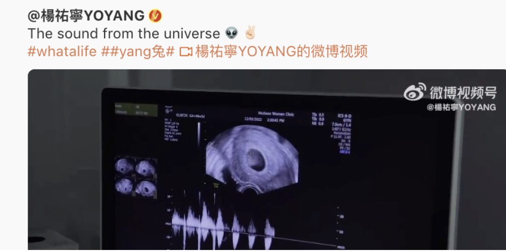 杨祐宁官宣二胎得女,自称想再生2个!妻子15分钟顺产,孕期才胖14斤