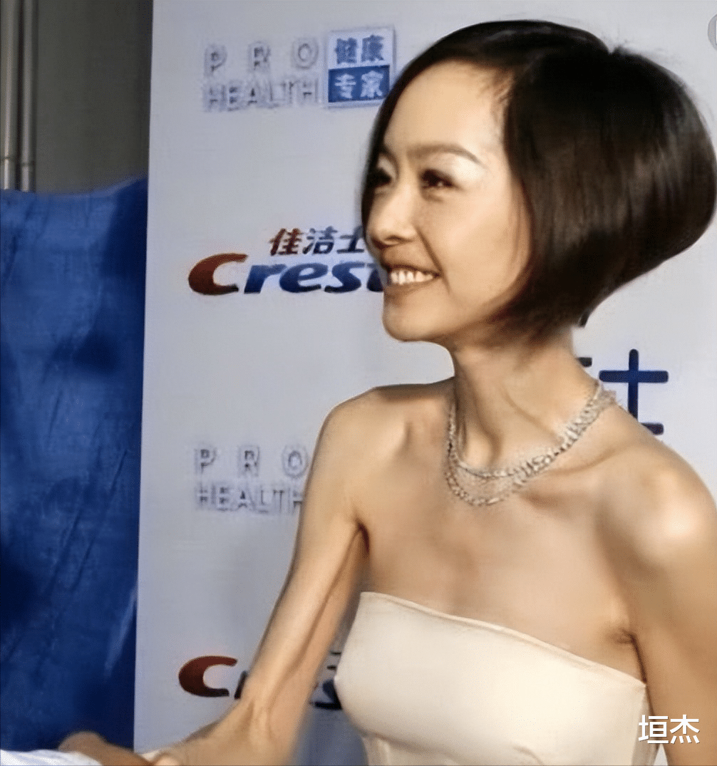 郑秀文|瘦脱相的10位女星：皮肉流失，行走的骷髅，瘦成纸片人真的不好看