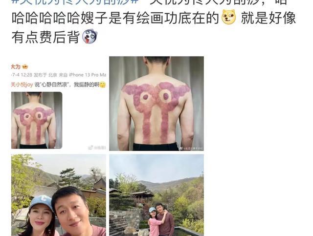 晒出关悦为自己刮痧照片乐翻网友佟大为深夜现身剧组拍戏