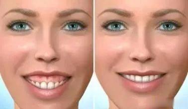 徐梦洁|小彩虹徐梦洁是被谁害了？甜心妹妹一夜变老十岁...