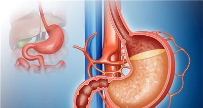 花生|一吃东西就“胀气”？医生：并非是胃病，或与3点有关，早了解