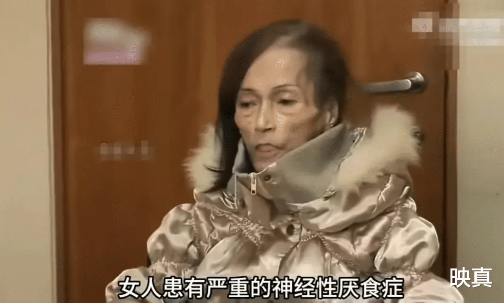 女子为爱疯狂减肥，连吃几年减肥药，硬生生从130斤减到31斤