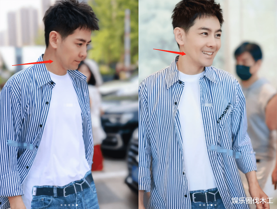 林志颖近照暴瘦，裤管空荡膝盖骨凸出，术后痕迹明显，面部不自然