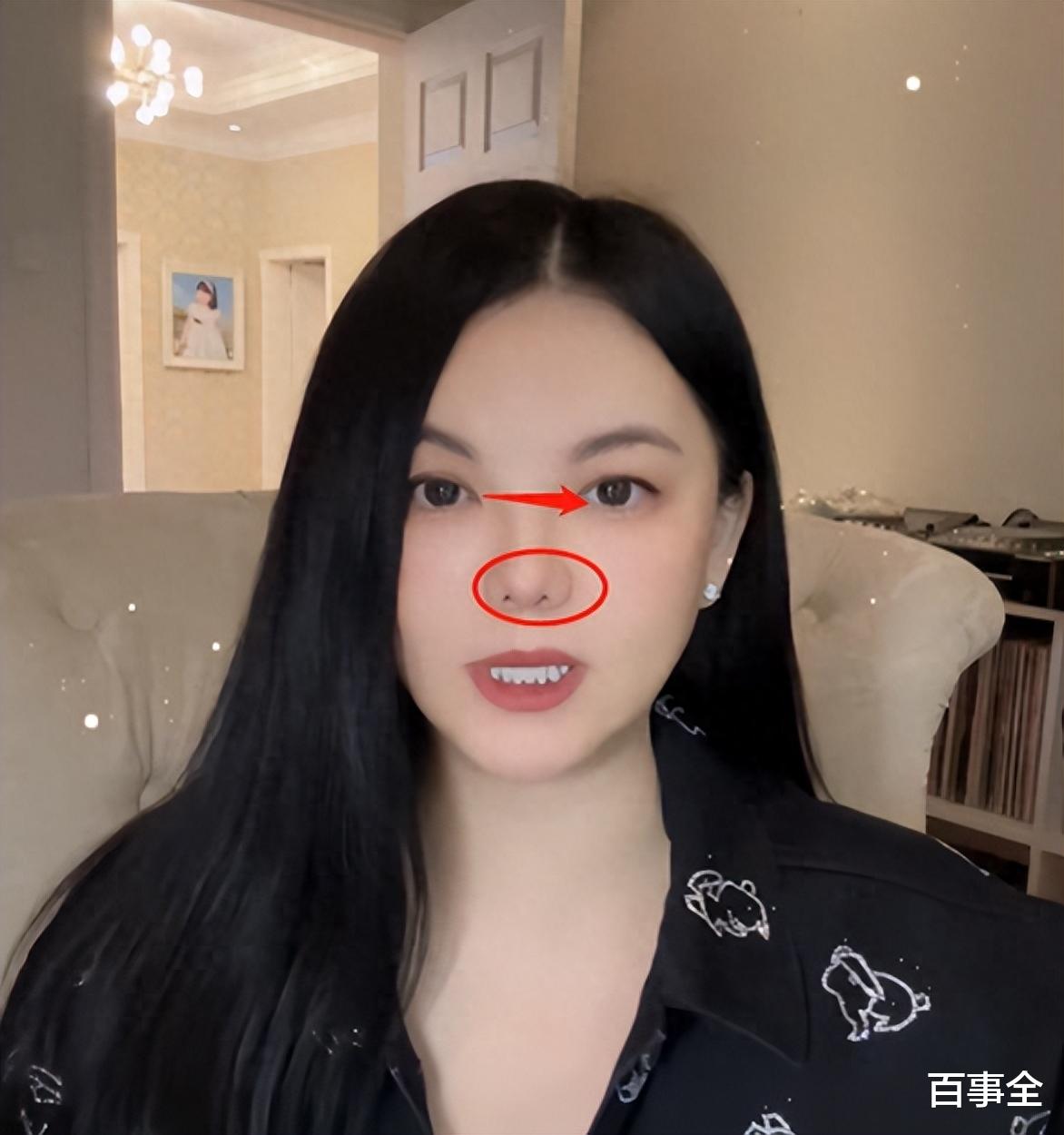 47岁李湘带女儿游日本,住高档酒店吃顶级寿司,山根肿胀鼻孔怪异