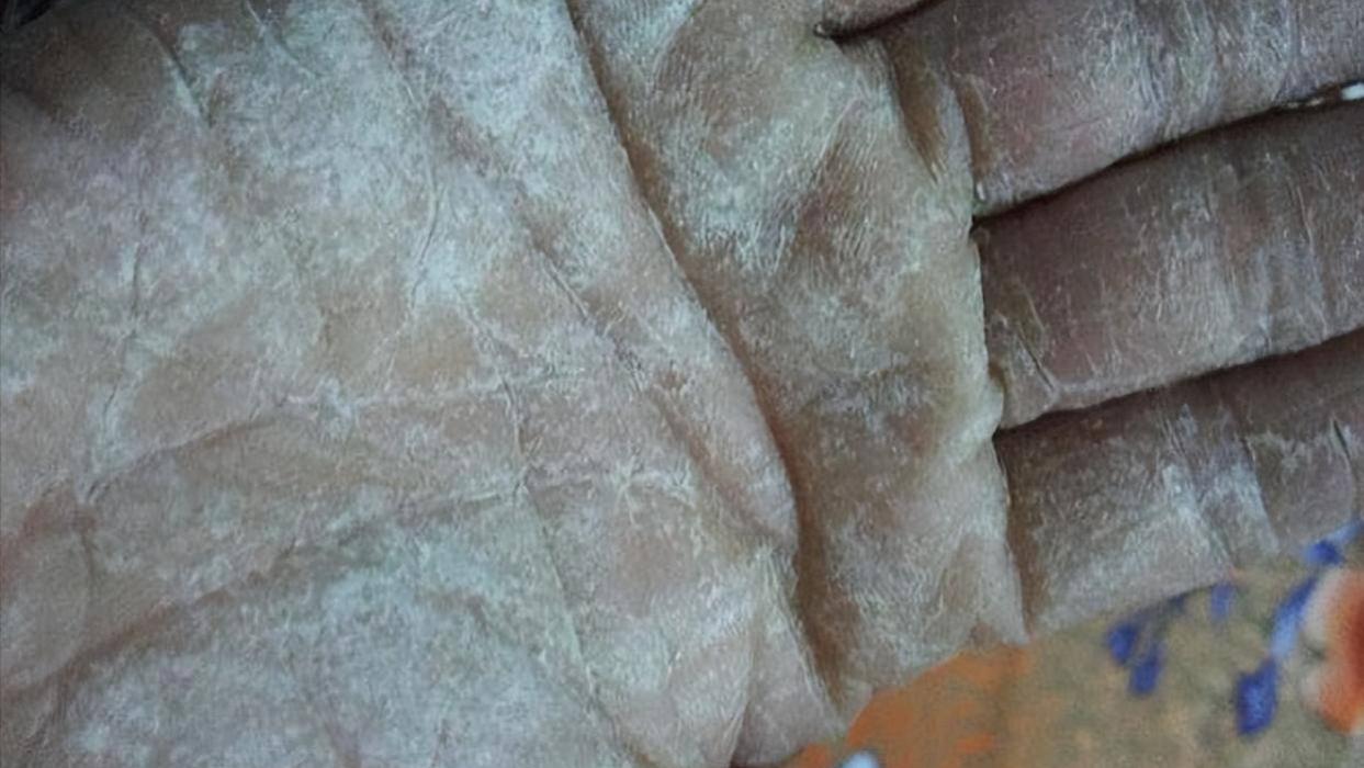 减肥 平价又好用的皲裂膏测评！干裂爆皮统统拿下！