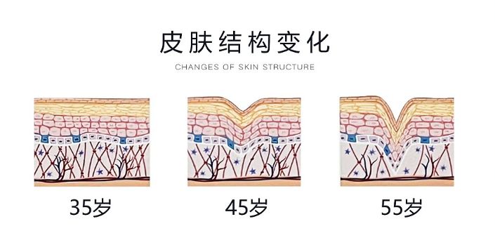 护肤干货 l 抗皱也要分龄?50+尤其要注意!