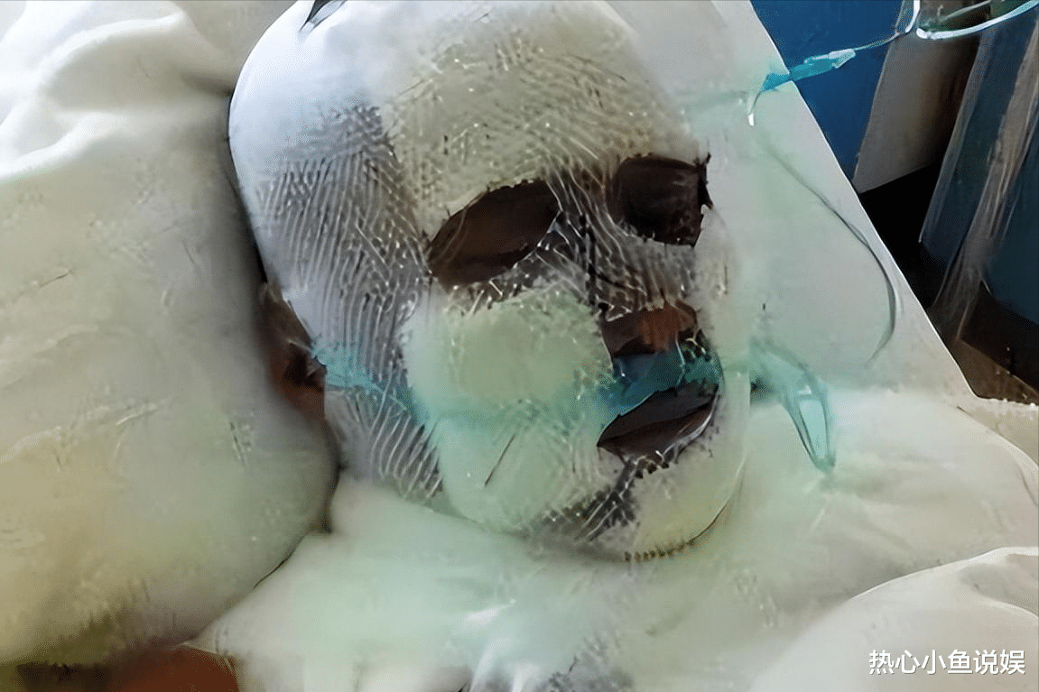 |央视春晚一曲成名，被砍下巴脱落缝130针变阶下囚，今卖马桶为生