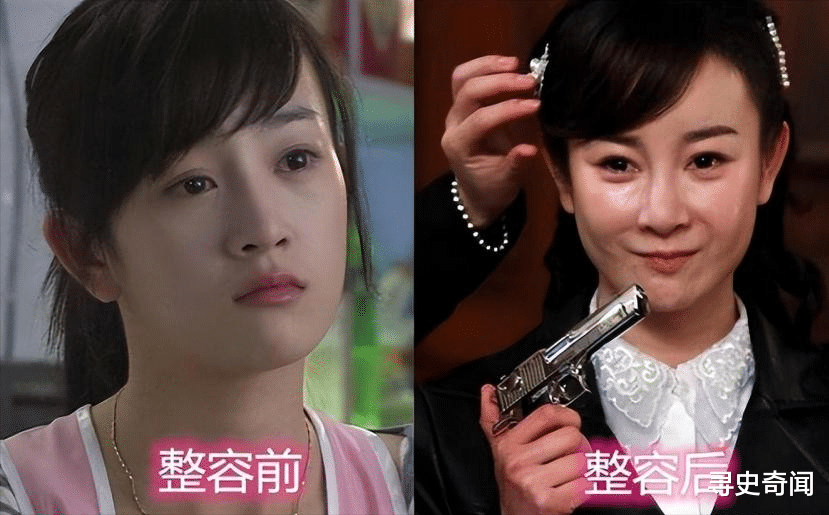 整容 整容成瘾、瘦成病态，娱乐圈里的“畸形”审美，什么时候到头？