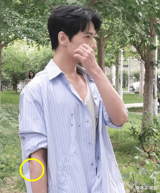 杨洋|31岁杨洋现身北外,手臂擦伤、穿搭另类,身高被质疑不到180cm!