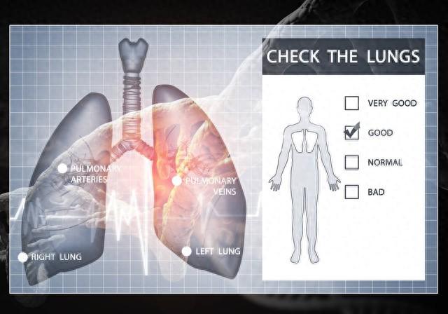 “肺纹理增多”,是一种什么病?会不会很严重?医生详解