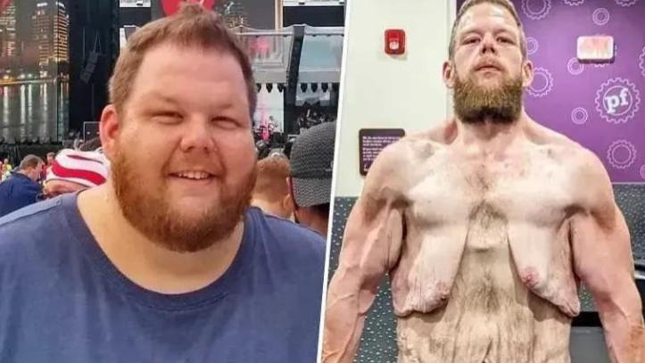 减重100斤的真实照片，身材如骷髅，为什么贾玲不这样？